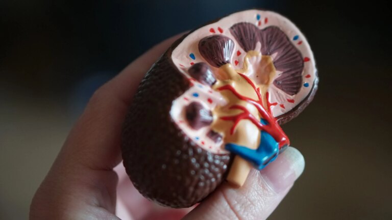 Predicting Hospitalisation of Kidney Dialysis Patients with AI